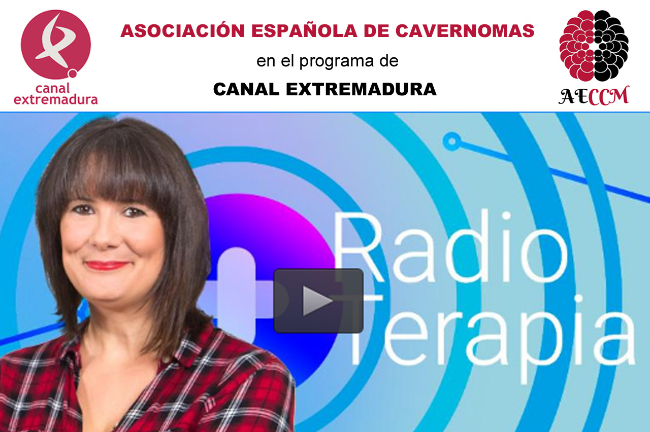 cavernomas-radioterapia-canal-extremadura